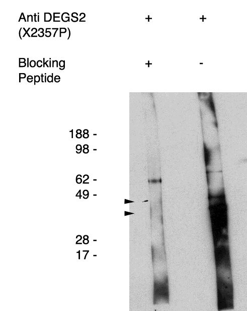 " Western blot using antigen immunoaffinity purified anti DEGS2 antibody (Cat. No. X2357P) on human kidney cell lysate.  Lysate used at 15 µg/lane.  Antibody used at 1:400 dilution.  Secondary antibody, mouse anti-rabbit HRP (Cat. No. X1207M), used at 1:50k dilution. Visualized using Pierce West Femto substrate system. Exposure for 5 minutes
"